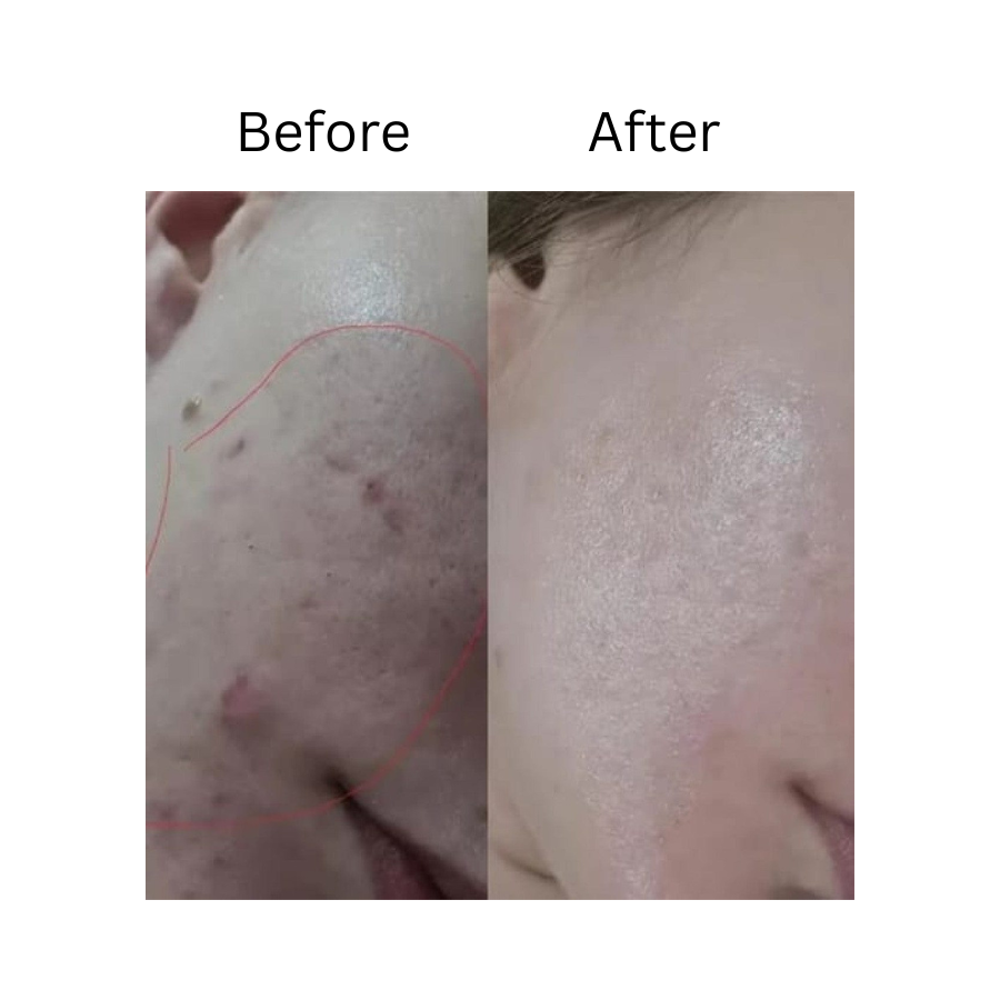 Melloq 345 Korean Relief Cream