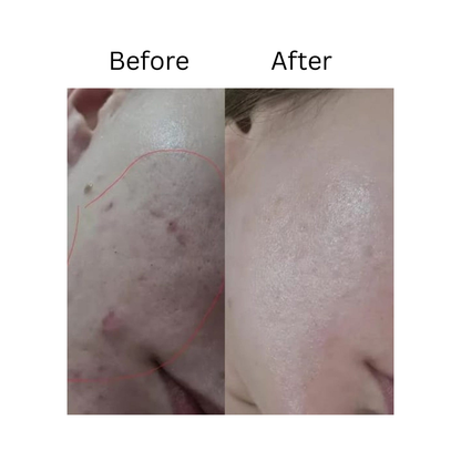 Melloq 345 Korean Relief Cream