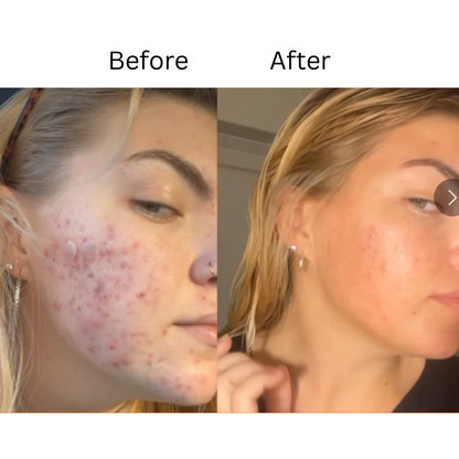 Melloq 345 Korean Relief Cream