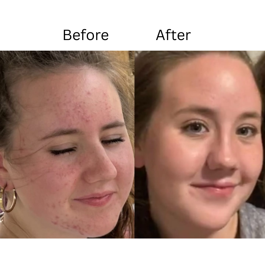 Melloq 345 Korean Relief Cream