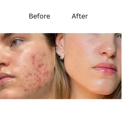 Melloq 345 Korean Relief Cream