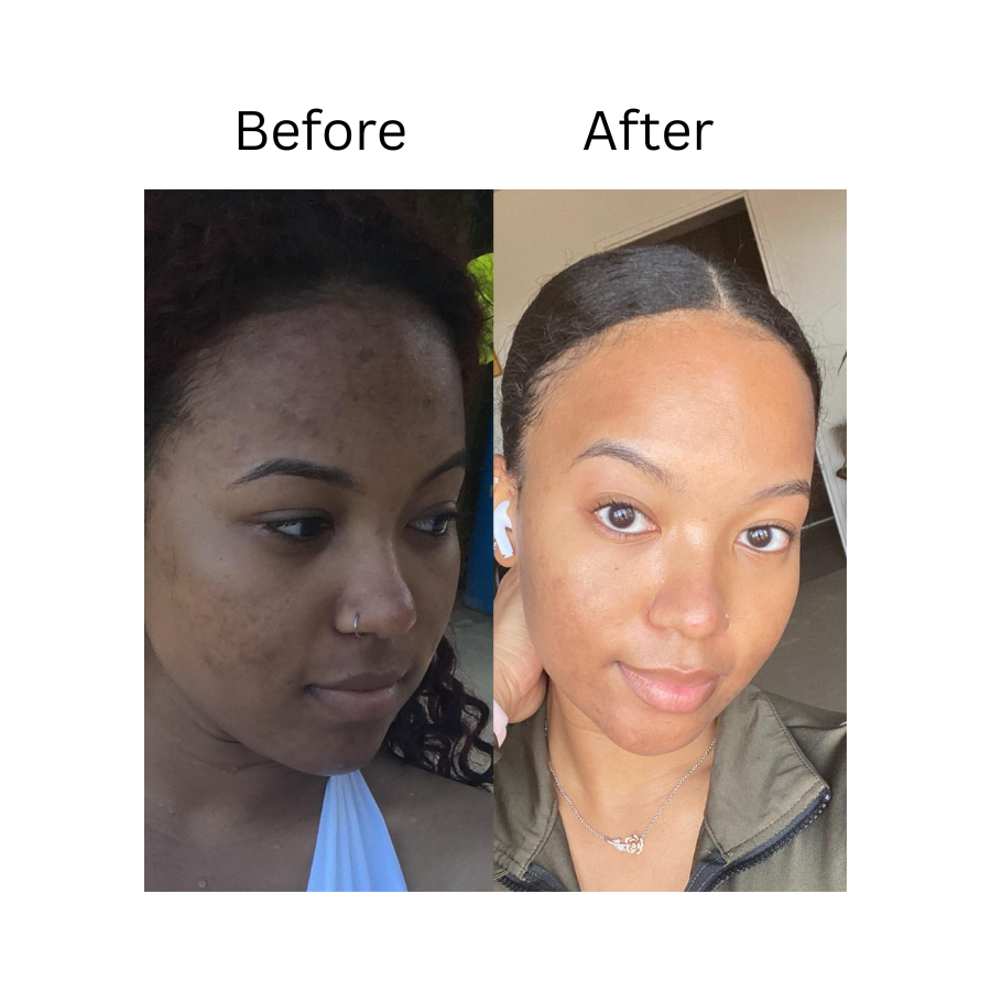 Melloq 345 Korean Relief Cream