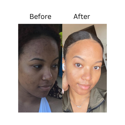 Melloq 345 Korean Relief Cream