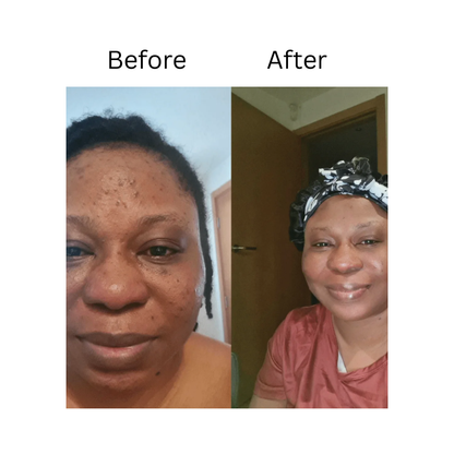 Melloq 345 Korean Relief Cream